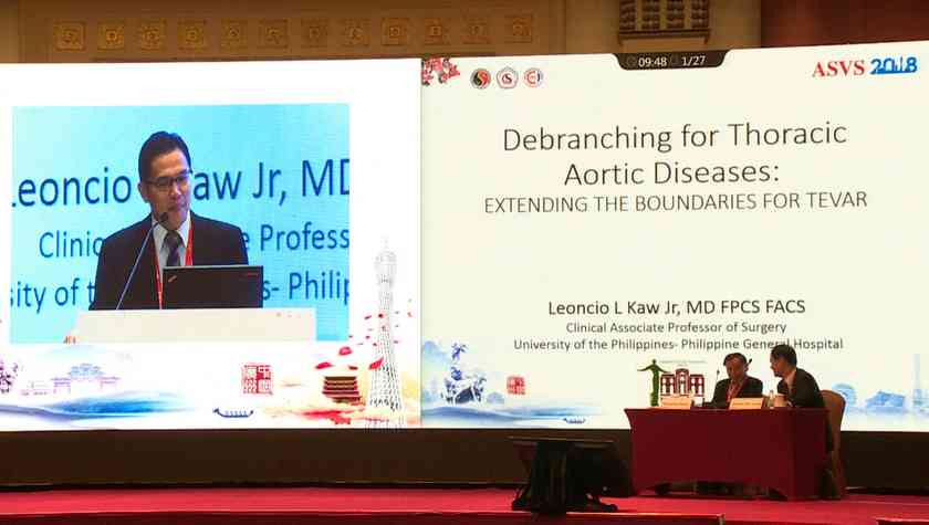 Leoncio L Kaw：Debranching for Thoracic Aortic Diseases